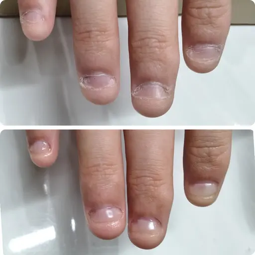 【ミニモ限定】長さだしなし✖️目立たず自然な自爪風✨【深爪補正|自爪育成クリア(マットも可)】
