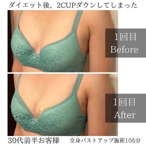 バストメニューOPEN限定価格