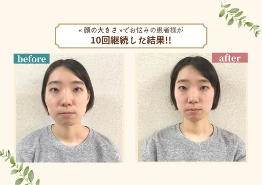 【小顔矯正・骨盤矯正】カラダとお顔の歪み改善ラボ美容整体プラスフィール姫路店