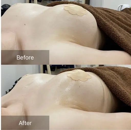 【最新NR機器を使用！】結果重視❣️ぷるふわバストアップケア❣️（上半身）