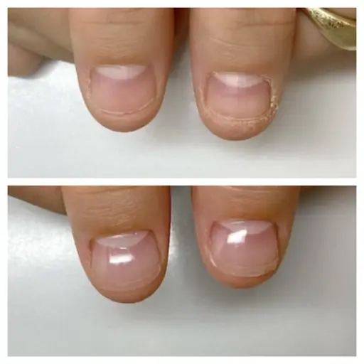 職場・学校OK🙆♀️|バレない深爪矯正(長さ出し+クリア【マット可】)