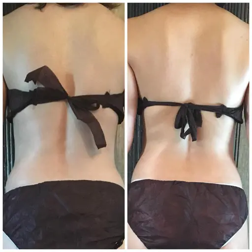 贅沢まるごと全身速攻痩せコース