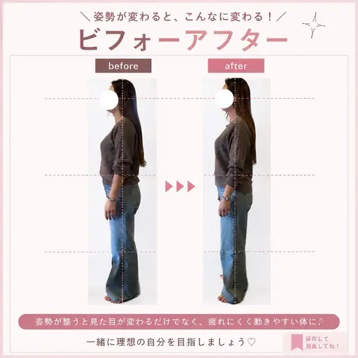 【5/18限定】AI姿勢診断+骨盤調整(60分)¥8.800▶︎¥4500