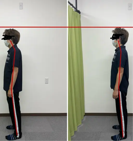 当店オススメ❗️腰痛、肩こり、ストレートネック、姿勢改善の方にオススメ☆もみほぐし＋ストレッチ75分¥5000