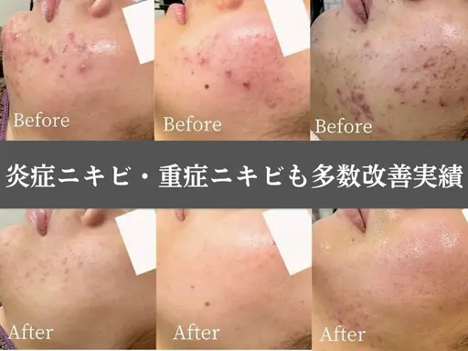 人気No.1【迷った方はこちら】当日ご相談◎何を選べばいいか分からない方