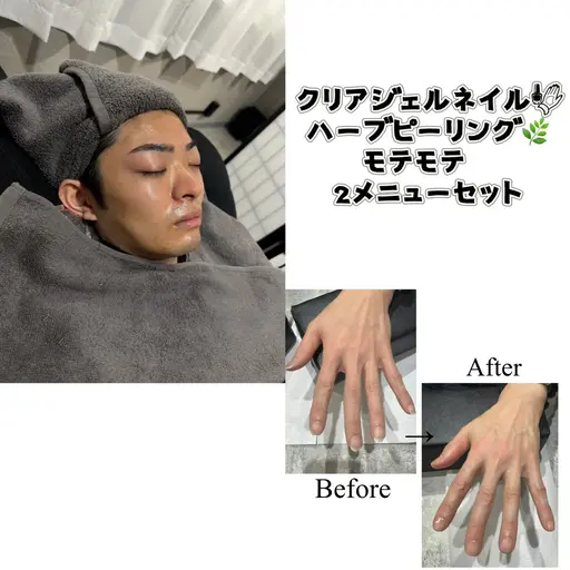🉐メンズハーブピーリングとクリアジェルネイル！2メニューセット！ハンドマッサージ、EMS美顔器、鼻毛WAX付き付き