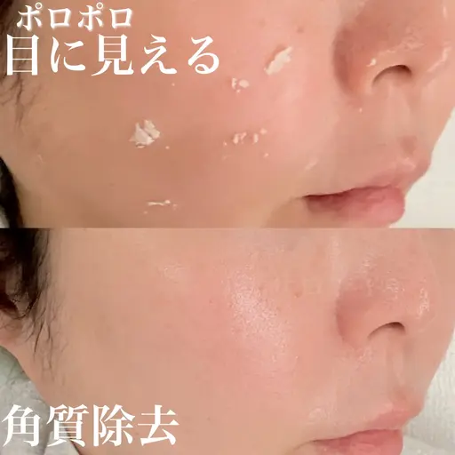 3月限定40%OFF★酵素ピーリング角質ポロポロ★天然由来成分でダウンタイムなし！