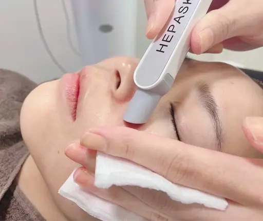 毛穴の黒ずみ・詰まりに毛穴洗浄