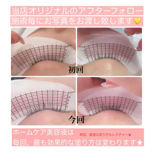 〈ラッシュアディクト（まつ毛ケア）〉¥4378ーインスタ&雑誌各社に紹介多数掲載💛最高級育毛サロン専門ケア(1回)