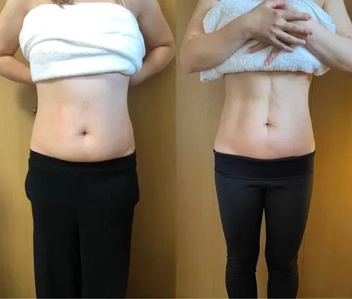 人気No1♡【下腹スッキリ！】腸もみで女性らしいキュッと引き締まったウエストGET(120分)