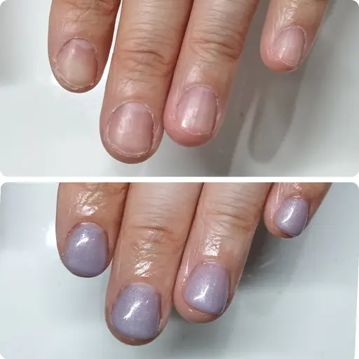 【残2名様限定】人前で見せられる指先へ💅|深爪矯正(長さ出し+ワンカラー)