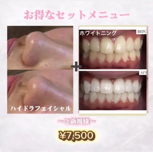 【🦋時短同時垢抜け お肌×歯set】一石二鳥の最強セット🕊️ハイドラフェイシャル×ホワイトニング