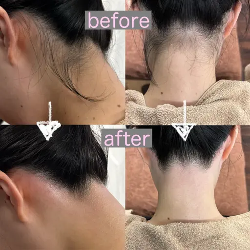 うなじWAX✨後ろ姿美人に🫧(デザイン込み)