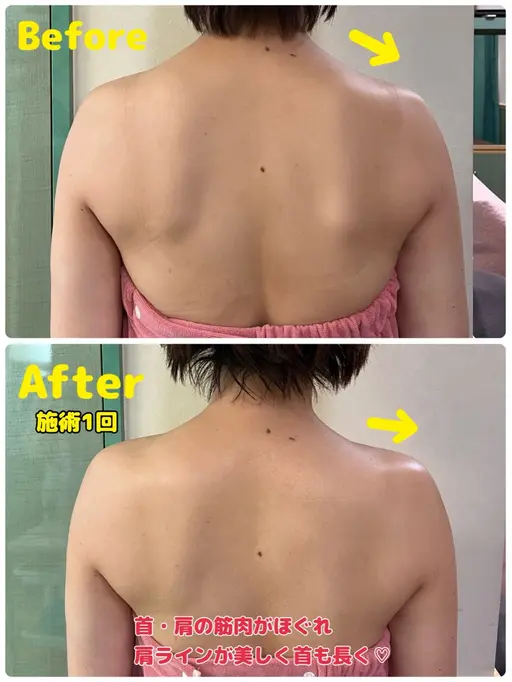 🧡ボディ・上半身🧡二の腕・背中・ウエスト【女性限定】