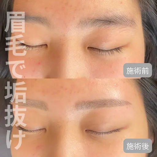 🫧予約殺到🫧美眉アイブロウWax脱毛