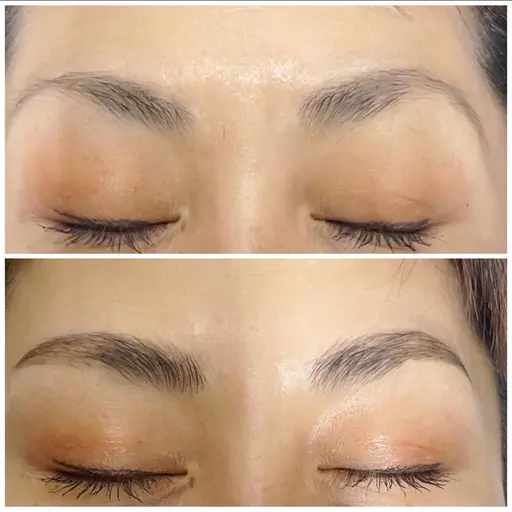 ハリウッドブロウリフト