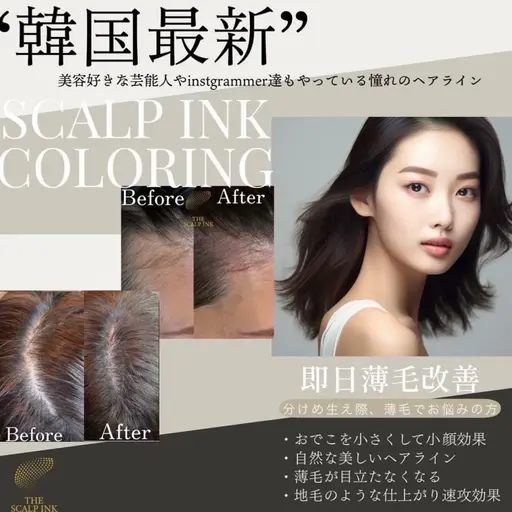 スカルプインク(韓国最新技術の頭皮タトゥー)30000万発66000円→33000円