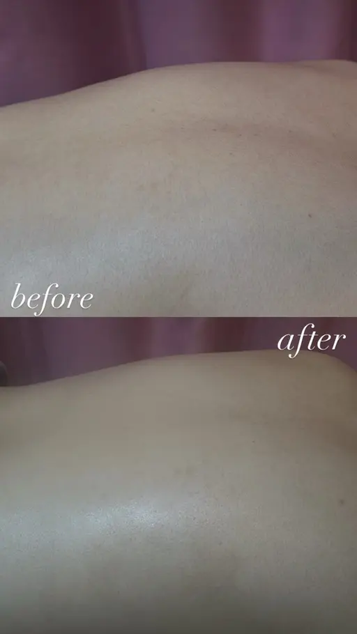 ［5/2限定］🤍動画撮影あり🤍5/2  18:30​〜​1名様限定✨背中、うなじシェービング🎀背中パック付き🎀