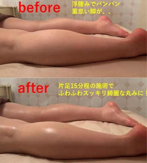 15%OFF✨脚の浮腫み撃退!脚デトックス×オイルケア130分(女性用)