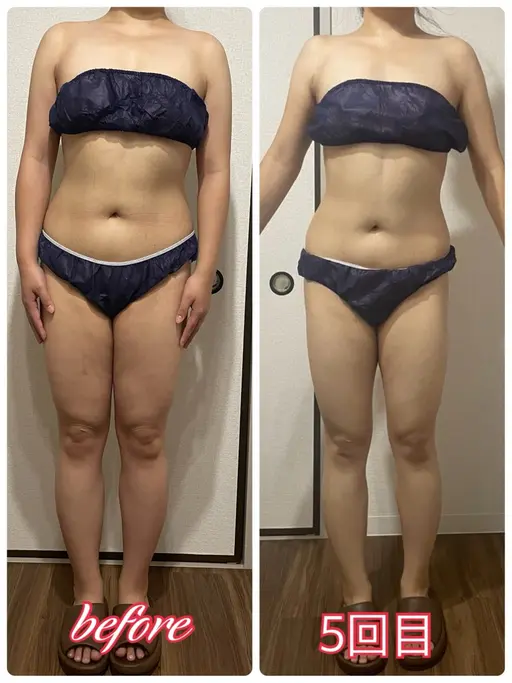 リヴァイセルボディ モニター募集‼️