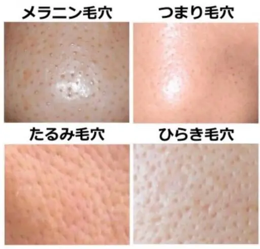 毛穴すっきりコース+メイク体験付き