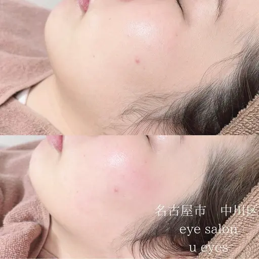 人気⭐️全顔フェイスWaxパック付き💠(注意事項、掲載情報をご確認後ご予約ください)