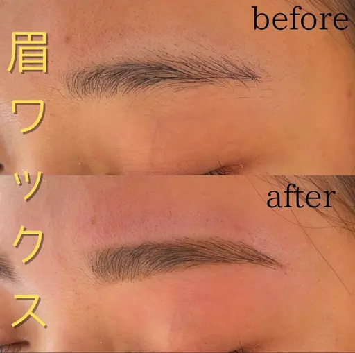 眉ワックス脱毛
