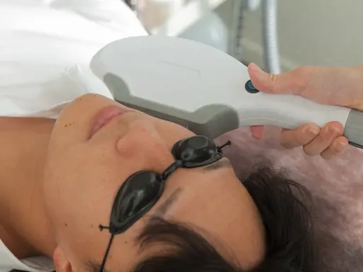 Open記念【学割U24】ヒゲ脱毛全体 ¥7900→¥500