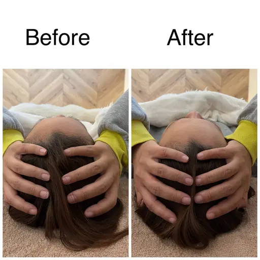 【脳疲労スッキリ】小顔ドライヘッドスパ