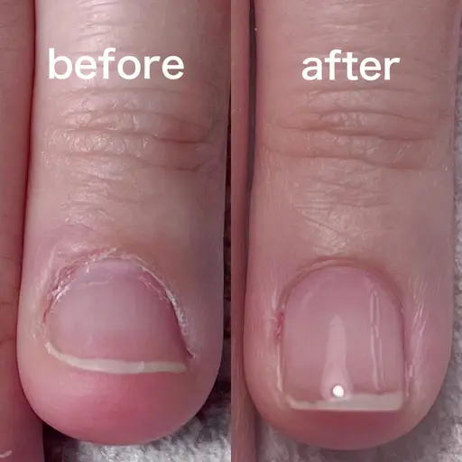 自爪育成／お試し価格[ミニオイル付き]