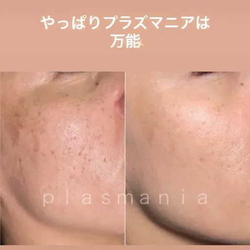 《リピーター様》土台を整えて肌を育てる✨