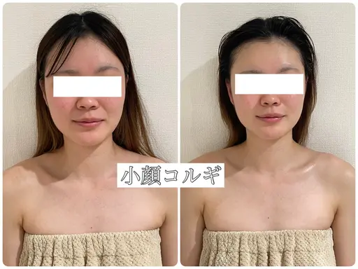 💖小顔矯正コルギモデル大募集💖⚠️補足説明必ずお読みください⚠️予約は《NAKAMURA》から🙇🏻‍♀️