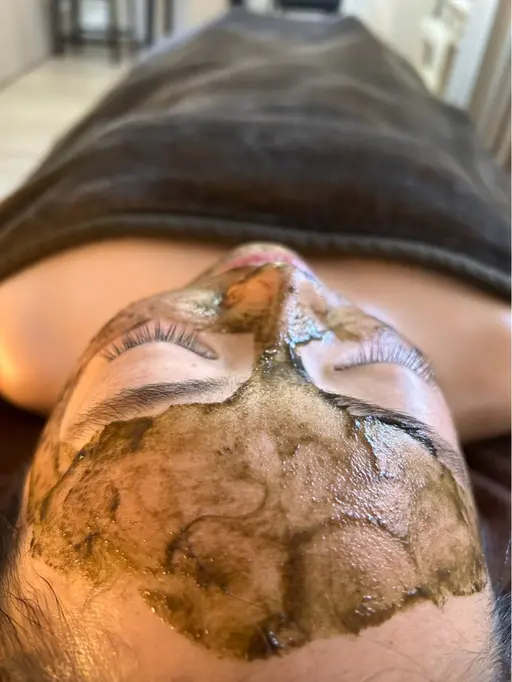 【お肌リボーンキャンペーン✨】剥離ありハーブピーリングレベルソフト14,000円→9,800円❣️❣️