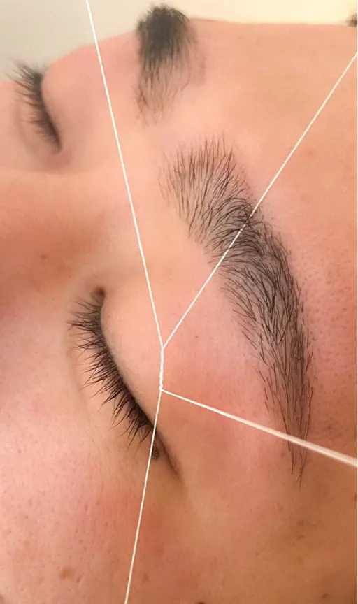 スレッディング脱毛