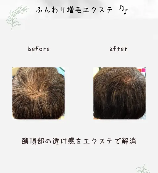薄毛で悩んでる方向けの増毛エクステ 200〜300本