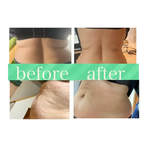 やせたい！肩こり腰痛産後の方にオススメ◎