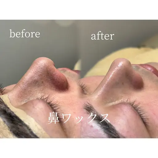 【オプション】鼻ワックス✨️ ⚠️こちらのメニューのみではご予約不可