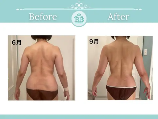 【全身痩身】バストを残してダイエット（機械付）⚫︎60分※すぐ予約のみ【1日2名限定OPEN記念モニター様】