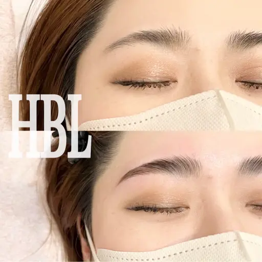 HBL(ハリウッドブロウリフト)