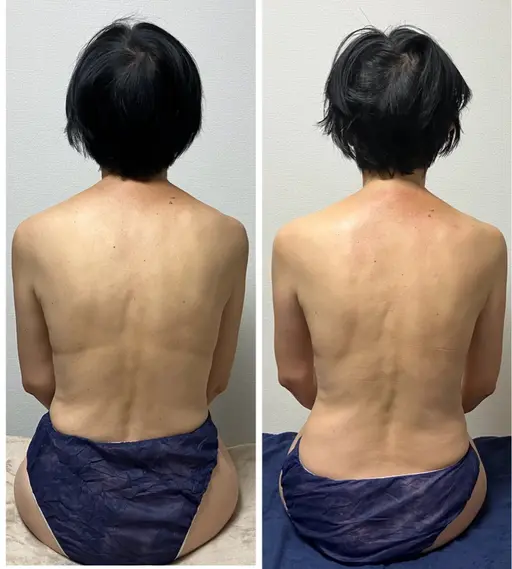 【minimo限定🧡ྀི】全身ほぐし＋肩甲骨＋CBDオイルデコルテネックヘッド60分