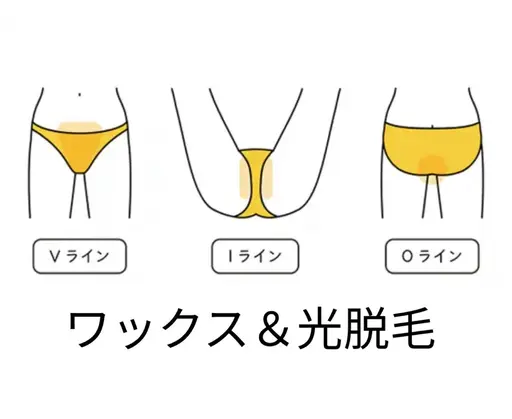 VIOダブル脱毛✨(ワックス&最新脱毛マシン)保湿ケア付き✨ツルスベ長持ち✨【女性限定】
