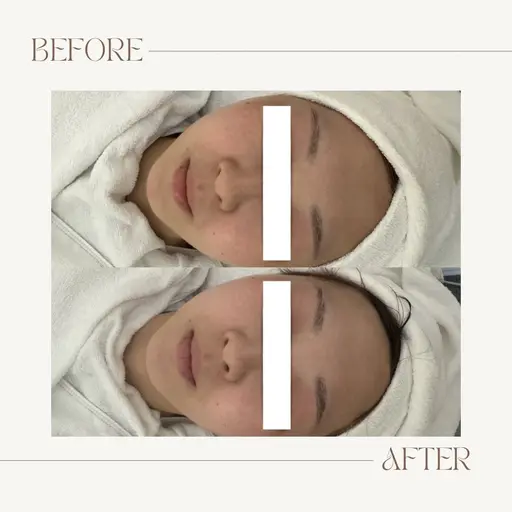 【ごわつき、乾燥、透明感🌼】フェイシャル、プチデコルテエステ💆‍♀️🫧ྀིプレゼント付き🧹