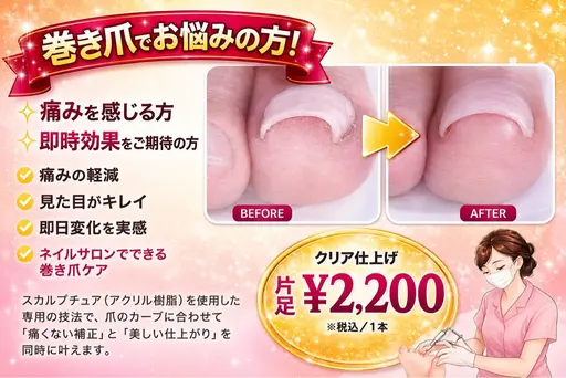 【親指巻き爪ケア】オフなしFOOT👣モデルカラージェル仕上げ🫧お写真、口コミいただける方のみ