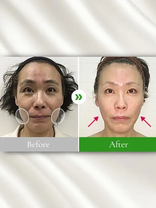 【ミニモ限定🌸】小顔整体コルギ1000円🌱全国50店舗記念キャンペーン✨