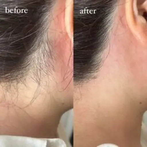 うなじWAXモデル、5名様募集🌻残り3名様