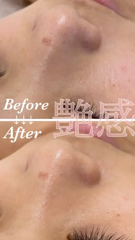 【毛穴/小顔/リフトアップ】毛穴洗浄+EMS+デコルテ+岩盤浴 80分