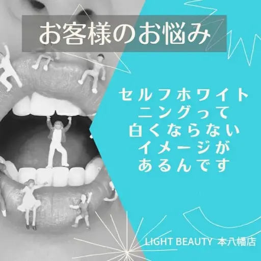 【ホワイトニング乗換割】他セルフホワイトニングサロン、歯科医で満足できなかった方💝チケットも割引あり!初回2,280円