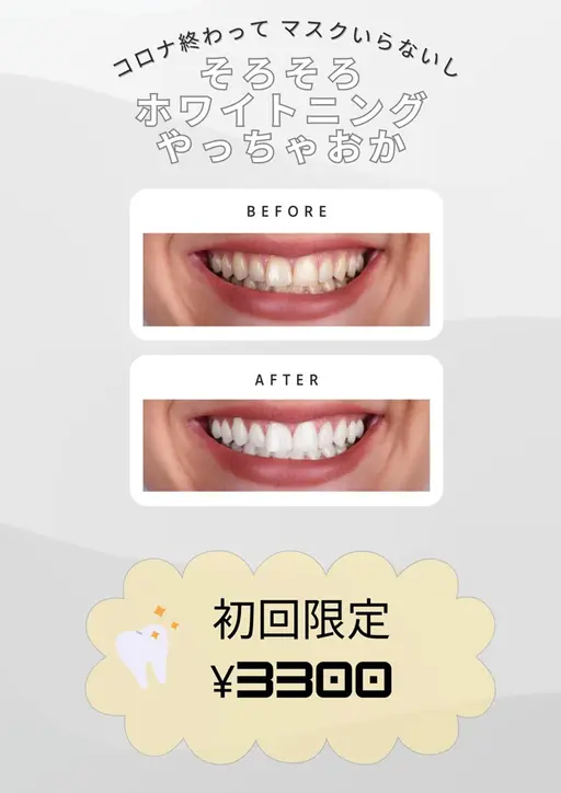 【医療用薬剤使用!】セルフホワイトニング2回目以降 5000円