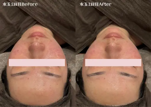 LDM水玉リフティング