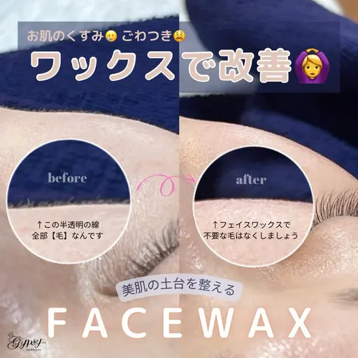 無料モデル✨【フェイシャルワックス】産毛処理◎ワントーン明るいお肌に！